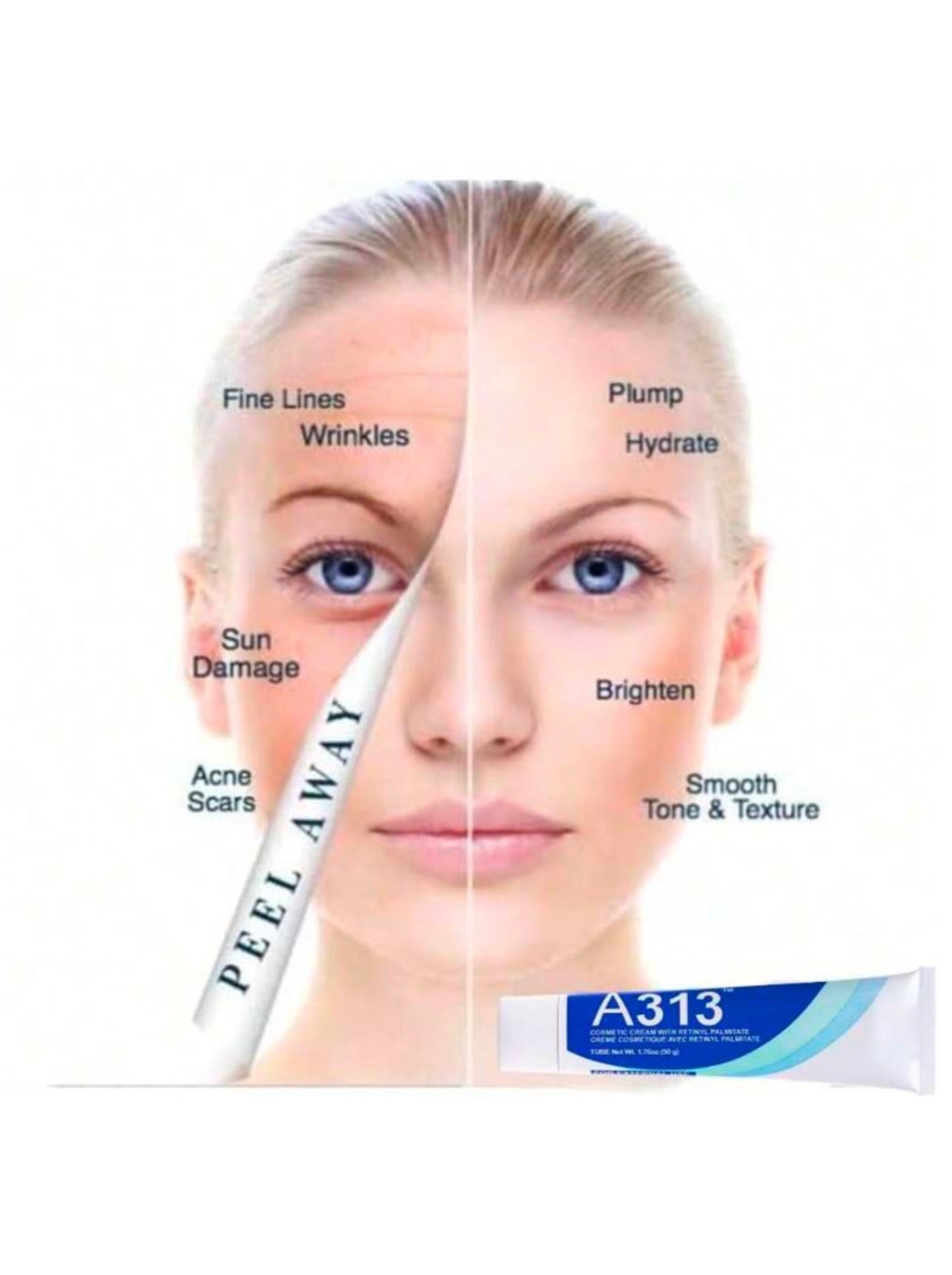 A313 Vitamin A Retinol Cream