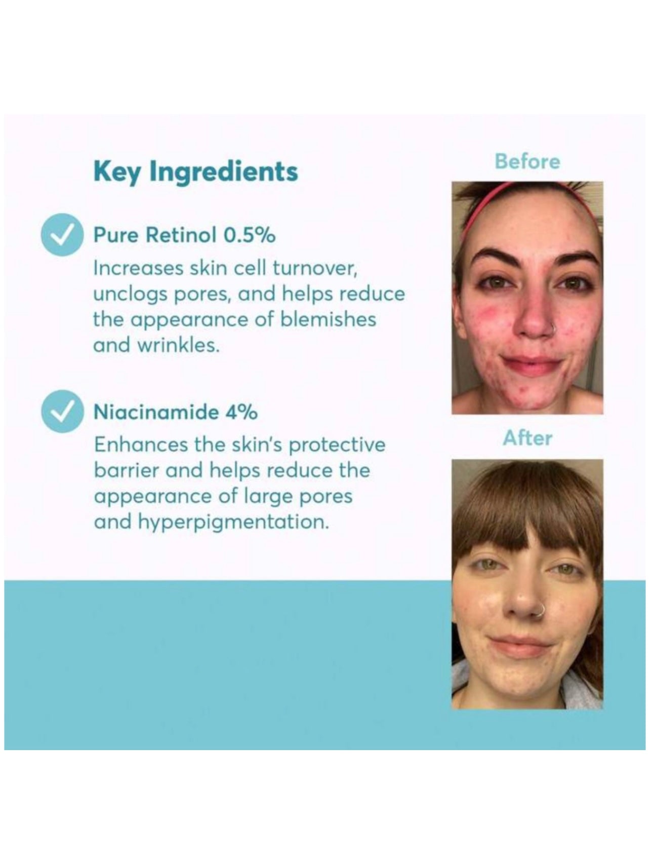 A313 Vitamin A Retinol Cream