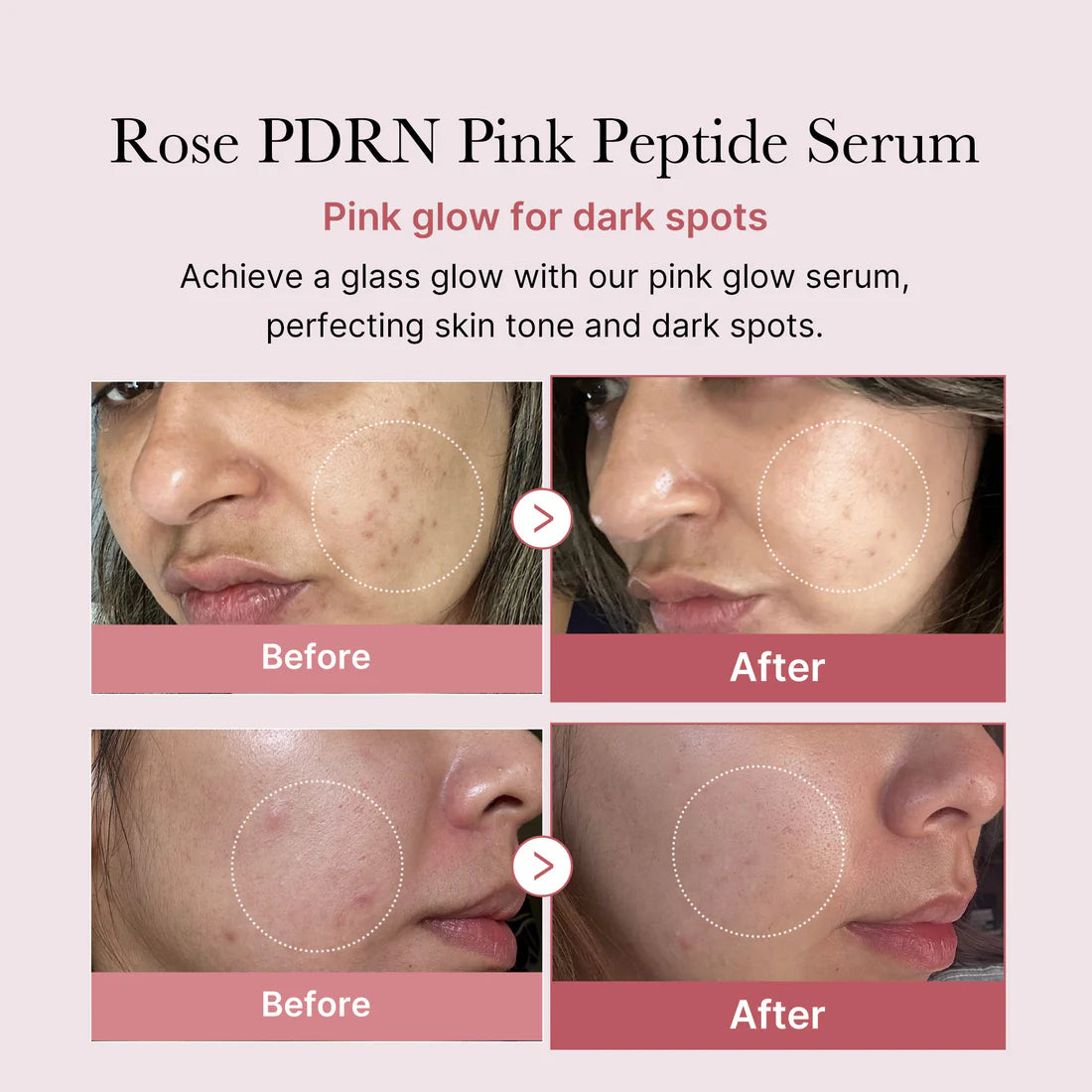 MEDICUBE PDRN Pink Peptide Serum - Advanced Anti-Aging Treatment